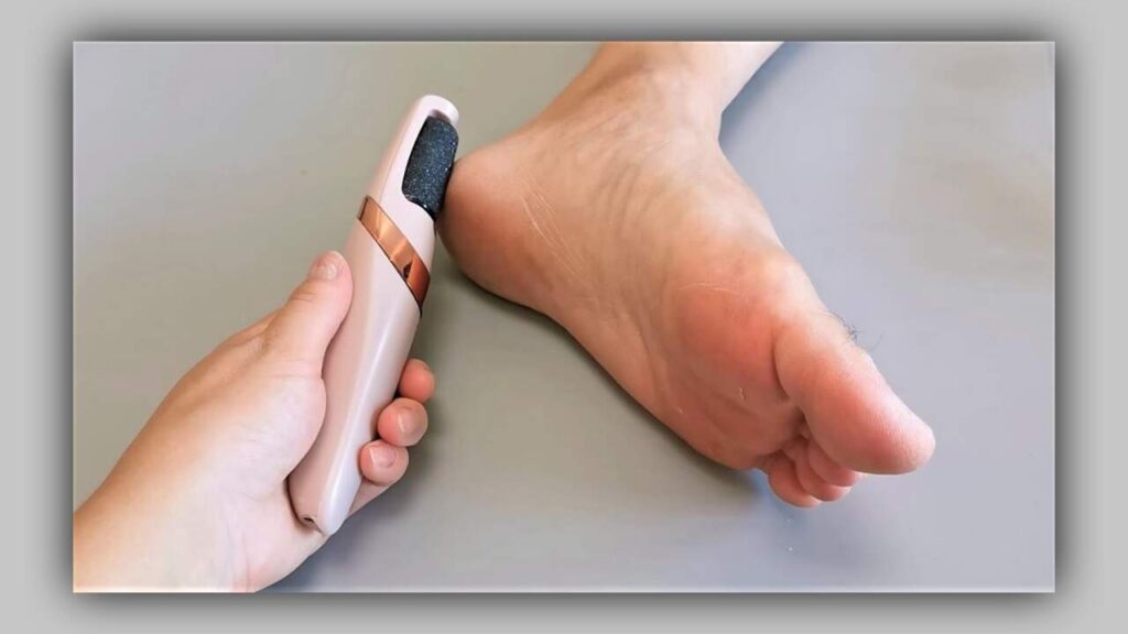 Benefits and Side Effects of Electric Foot Callus Remover in 2024